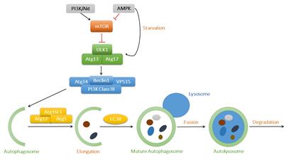 Autophagic Regulation of Lipid Homeostasis in Cardiometabolic Syndrome